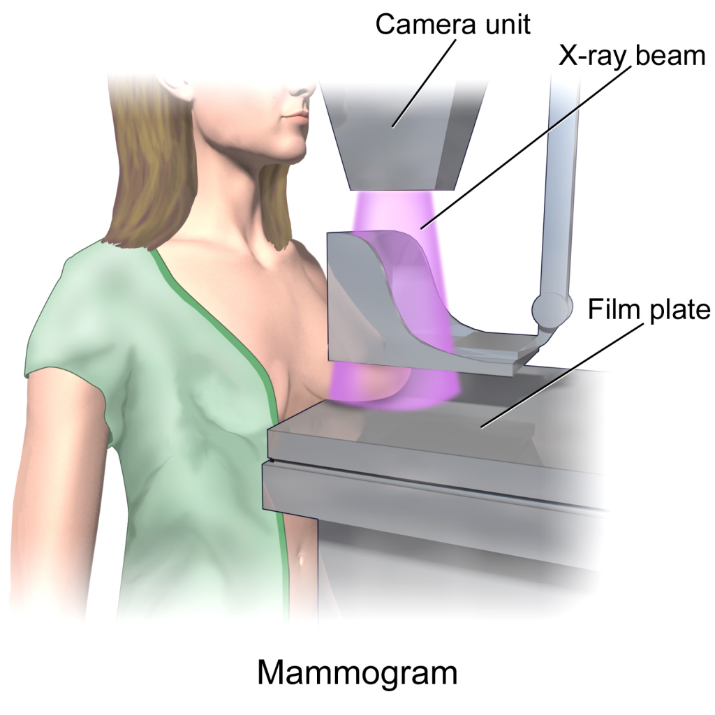 Mammography Unit Opening